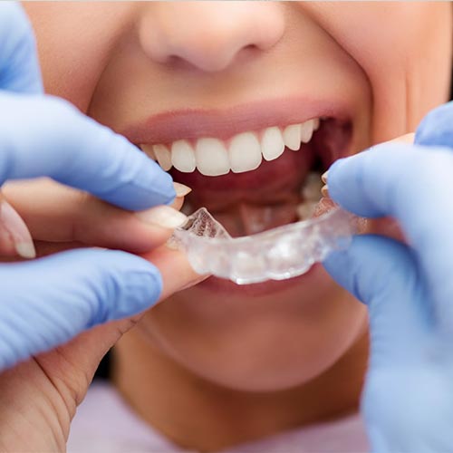 dentist placing invisible braces